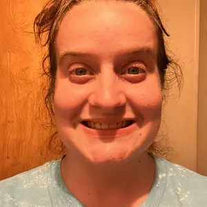 Ceelike Nano Hydroxyapatite Toothpaste | Repairs & Strengthens Enamel | Fluoride-Free & Fresh Mint | Enhances Natural Shine