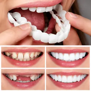 White Denture Belt Veneer-Unisex Upper and Lower Denture Care-Flexible and Comfortable, Realistic, Dental Solution