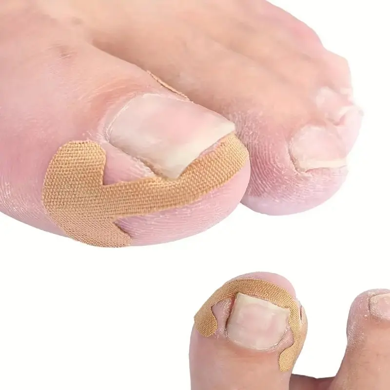 Toenail Correction Patches, Ingrown Toenail Strips, 60pcs/set Ingrown Nail Correction Sticker, Nail Care Tool for Men & Women, Manicure & Pedicure Tool, Nail Pedicure Kit