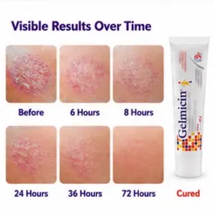 Gelmicin Soothing Skin Care Cream (40g/1.41 oz) - Relief for Skin Allergies, Itch, Poison Ivy Rashes