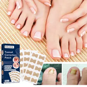 Eelhoe Toe Nail Correction Stickers Ingrown Nail Correction Repair Toe Nail Art Toenail Straightening Sticker Manicure Cutics