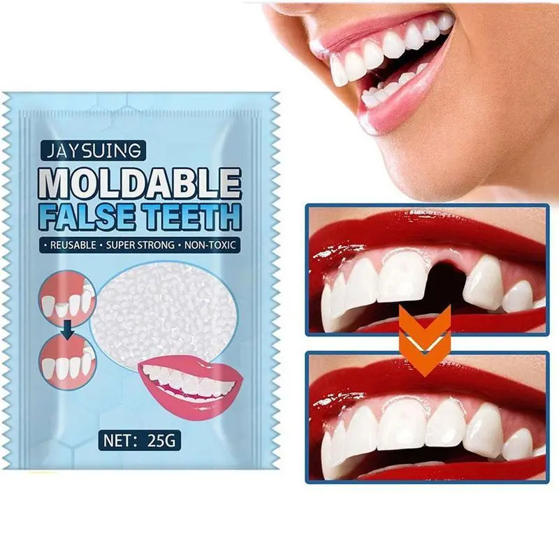 25g Natural Resin Temporary Oral Repair Kit, Easy-Repair Odor-Free Reusable Denture Adhesive Glue for Gaps & False Teeth, Teeth Beauty Solution