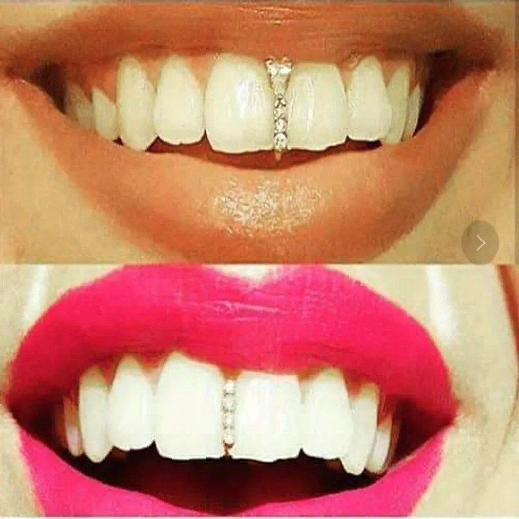 5-Pack Golden Halloween Zirconia Vertical Bar Tooth Gem Grillz, Fashion Costume Body Jewelry Accessory