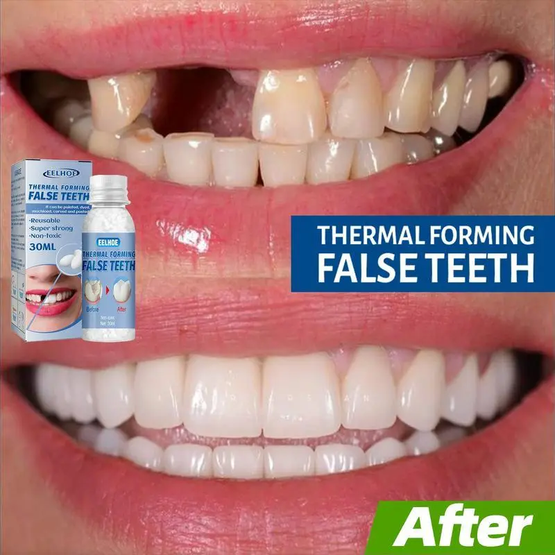 1pCs EELHOE Moldable Dental GelDenturesTemporary Fillings Cavities andTeeth FillingsTemporary Tooth FillingDenture Kit Oral falsehome teeth