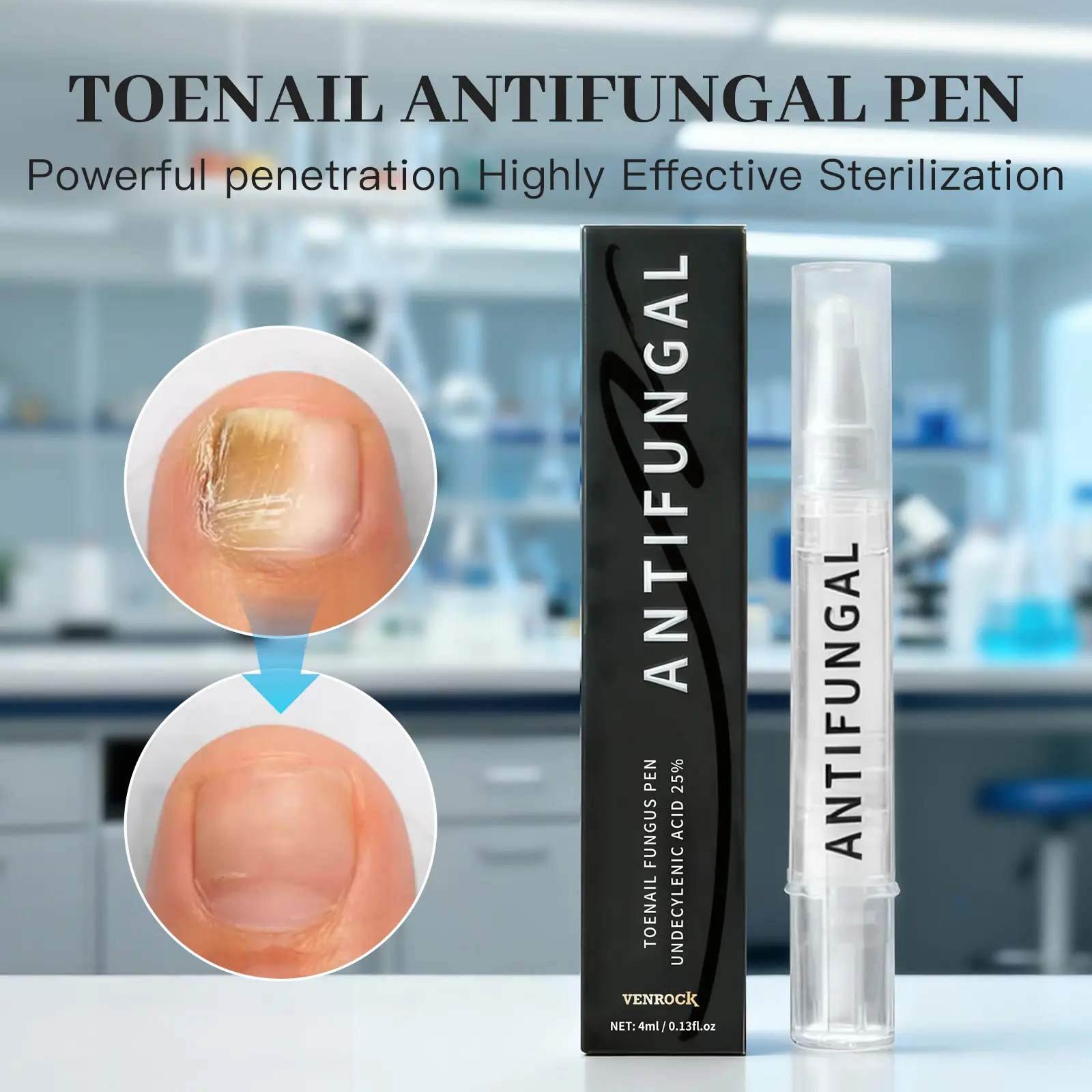 25% Undecylenic Acid Antifungal Toenail Pen, Deep Penetration Nail Care Solution - Targets Athletes, Treats Athlete’s Ft, Jock Itch, Fungal Nails, Supports Healthy Skin - Therapeutic Black Friday Gift