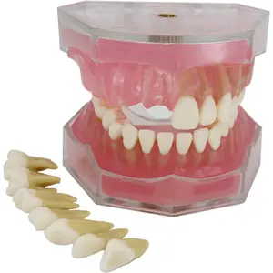 Dental Implant Teeth Model with Removable Teeth for Dental Professionals and Students