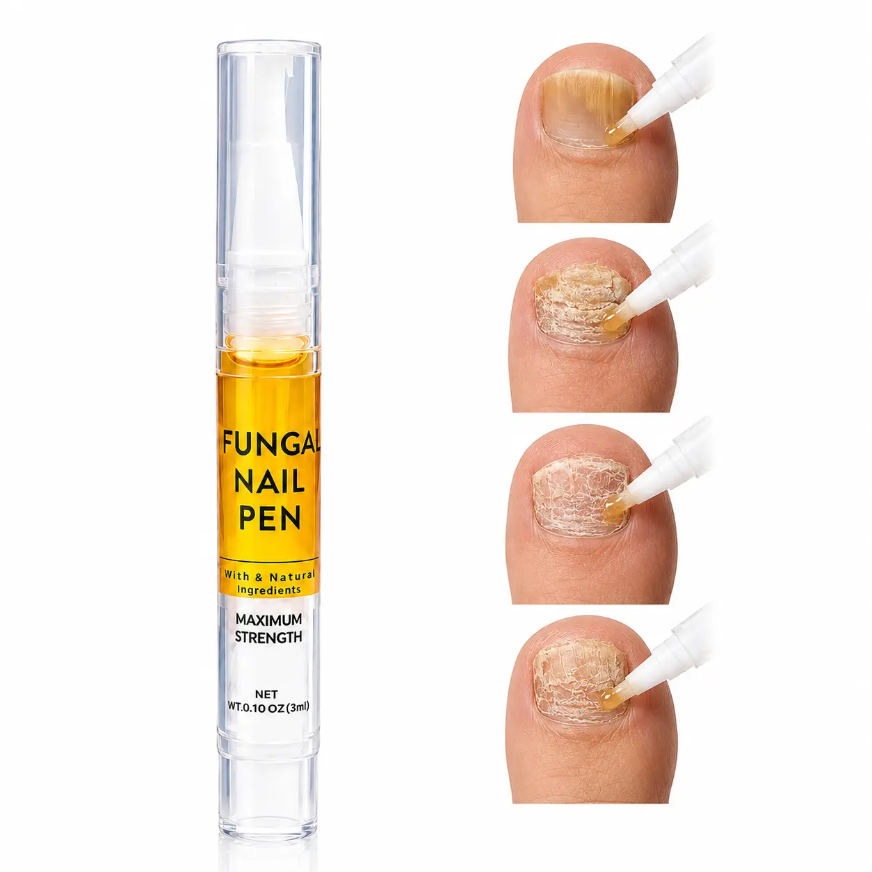 Nail Care Brush Pen, 2.5mL Precision Nail Conditioning Serum, Improves Nail Appearance & Shiny Finish, Moisturizing Cuticle Care, for Dry Rough Dull Toenails, Lightweight Daily Care