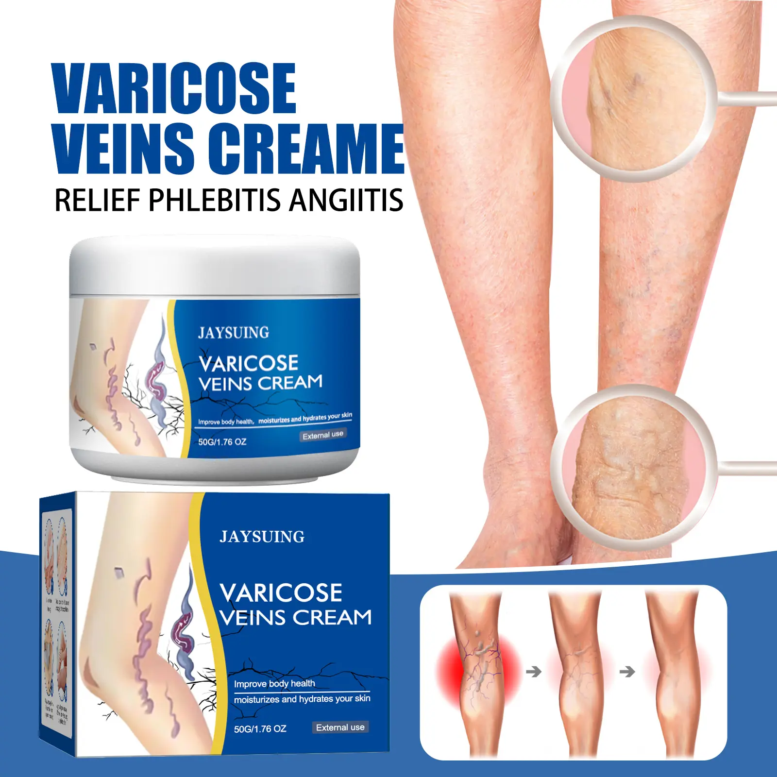 JAYSUING Leg Relieve Cream 50g Varicose Veins Cream Leg Repairing Moisturizing Body Care for Leg Relief Moisturizer Soothing