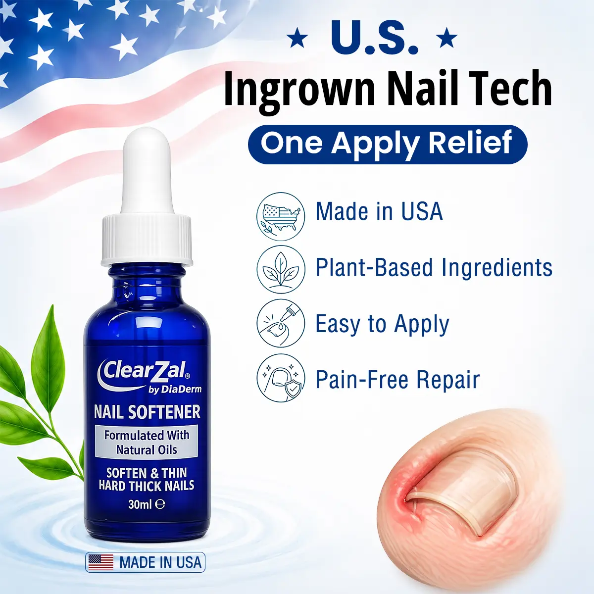 ClearZal nail softener  Ingrown Nail Fix Ingrown Toenail Relief & Softening Solution, Extra Strength for Thick Hard Nails, ingrown toenail removal,  nail softener solution,  Professional Nail Care Fix, 1 fl oz / 30ml
