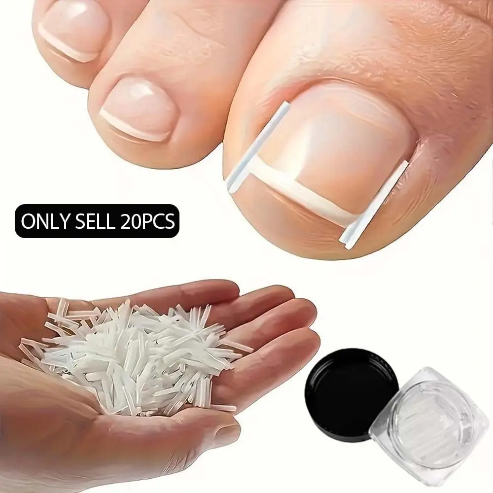 20/40pcs Ingrown Toenail Strips - Foot Nail Care Tools, DIY Pedicure Care Tool, Nail Pad Set, Easy to Use, Daily Foot Care Accessories for Men and Women