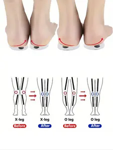 1 Pair Shoe Insoles, Women's O/X Leg Shoe Pad, Magnetic Heel Cushion, Arch Support Insoles, Plantar Fasciitis Insoles, Soft Cushioned Insoles, Anti-slip Shoe Inserts For Women & Men