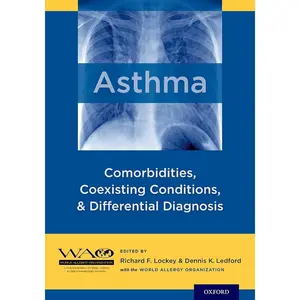 Medical Science Book for Asthma Sufferers: Exploring Asthma, Its Comorbidities, Coexisting Conditions, Differential Diagnosis and Links to Allergic Diseases