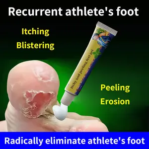 Miao's Athlete's Foot Cream: Relieves itching, removes peeling, kills fungi, stops foot itch, deodorizes, repairs cracked feet, treats blisters between toes and eliminates foot odor.