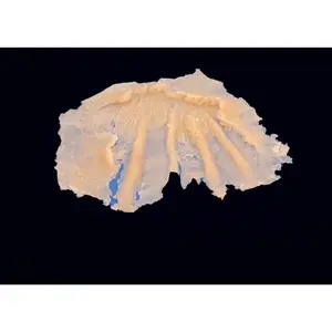 Silicone Prosthetic Top of Hand Injury Degloving