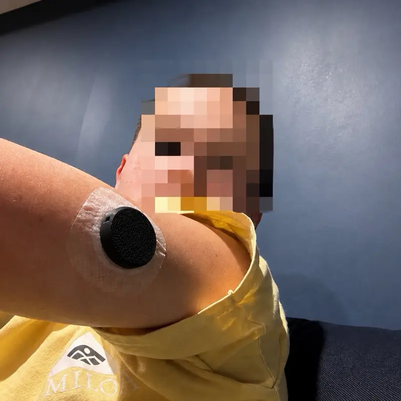 Protective Cover Compatible with Dexcom G7 | Dexcom G7 Sensor Guard | 3D Printed Sensor Protector | Lightweight Diabetes Accessory