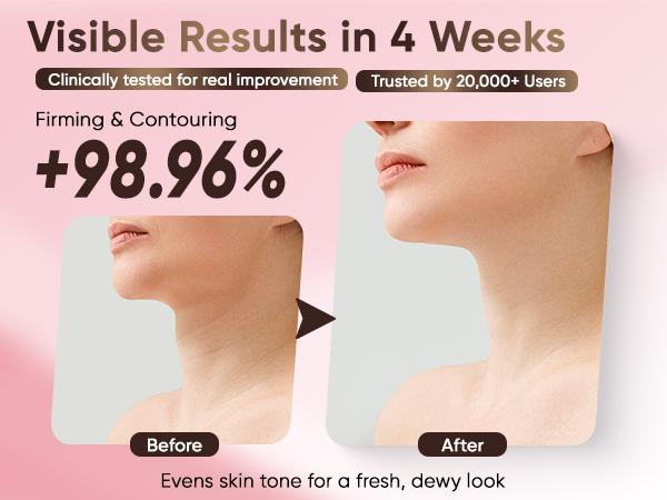 Misoour Neck Mask Set:Collagen Peptide Anti-Wrinkle Neck Mask + Astaxanthin Firming & Smoothing Serum|Reduce neck wrinkles, Moisturize and brighten,Firm and lift#TikTokShopBlackFriday Misoour Neck Mask Set:Collagen Peptide Anti-Wrinkle Neck Mask + Astaxanthin Firming & Smoothing Serum|Reduce neck wrinkles, Moisturize and brighten,Firm and lift#TikTokShopBlackFriday