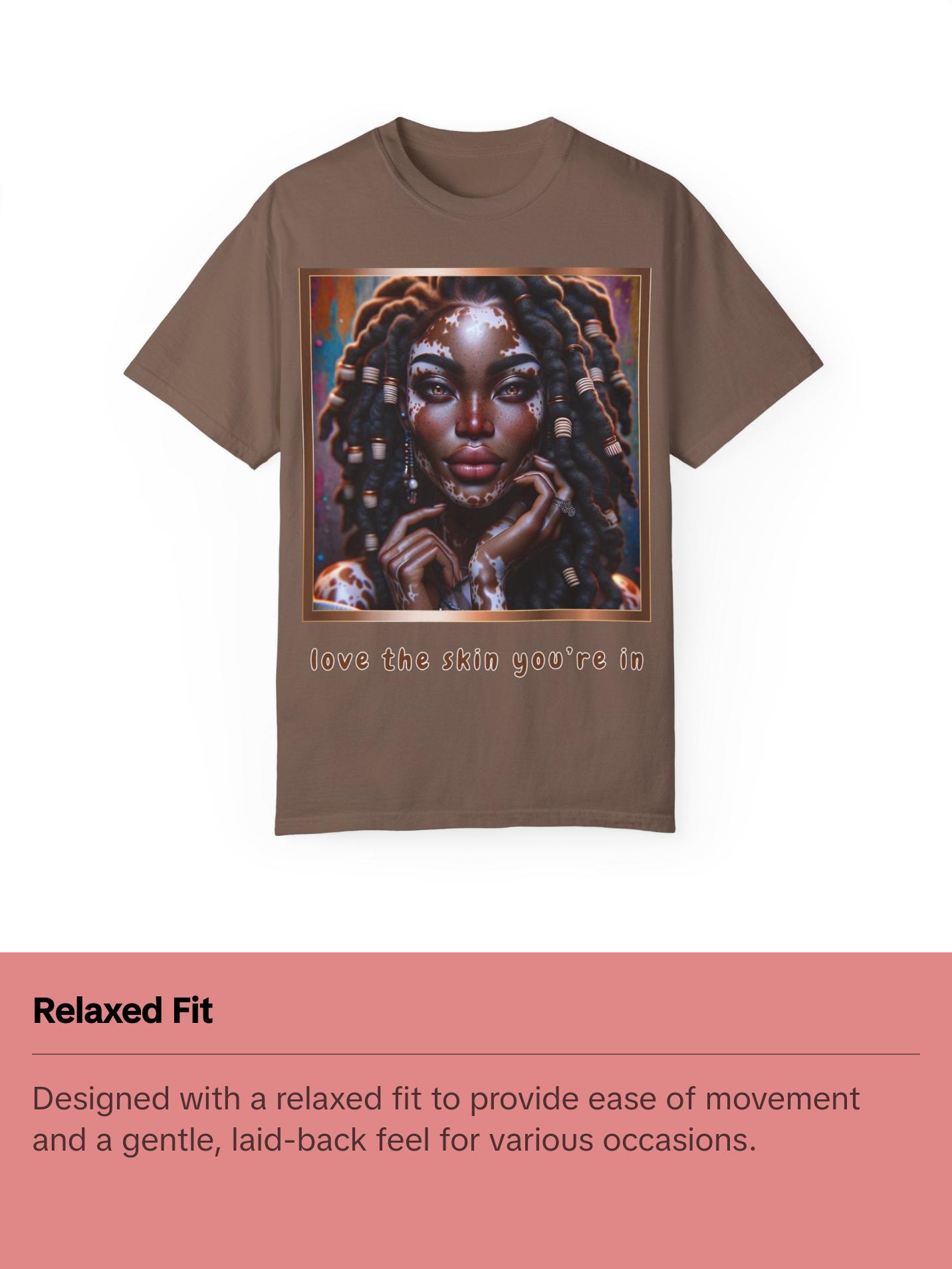 Exquisite Expressions: Celebrating the Unique Beauty of Vitiligo T-Shirt, Love the skin you're in Womenswear Casual Fashion Comfort Streetwear Exquisite Expressions: Celebrating the Unique Beauty of Vitiligo T-Shirt, Love the skin you're in Womenswear Casual Fashion Comfort Streetwear