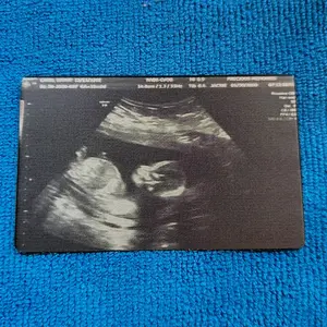 Custom laser Ultrasound Aluminum Anodized Cards, Great for gifts, gender reveals, christmas and personal.