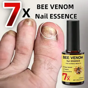 Quick-Acting Bee Venom Nail Cream, Contains Plant Extracts & Bee Venom, Physical Exfoliation, Moisturizes Cracked Nails & Heels, Suitable for All Skin Types
