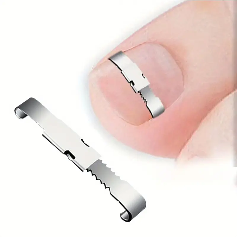 4-Piece Nail Correction Set, Stainless Steel & Elastic Patches Foot Care Combo, Pedicure Kit for Toe Alignment, Comfortable Fit, Basic Nail Tools, Foot Care Product