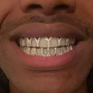 2-Piece Iced Out Grillz Set - Open-Face Hip Hop Teeth Grillz, Silvery and Golden Colors - Novelty Dental Body Jewelry for Adults 14+