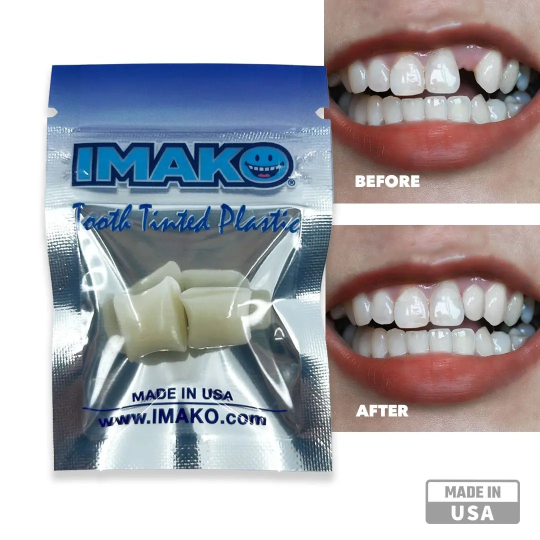 Imako Tooth Tinted Plastic - Moldable Temporary Tooth - Shape It Yourself in Minutes - Made in USA