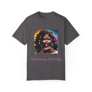 Exquisite Expressions: Celebrating the Unique Beauty of Vitiligo T-Shirt