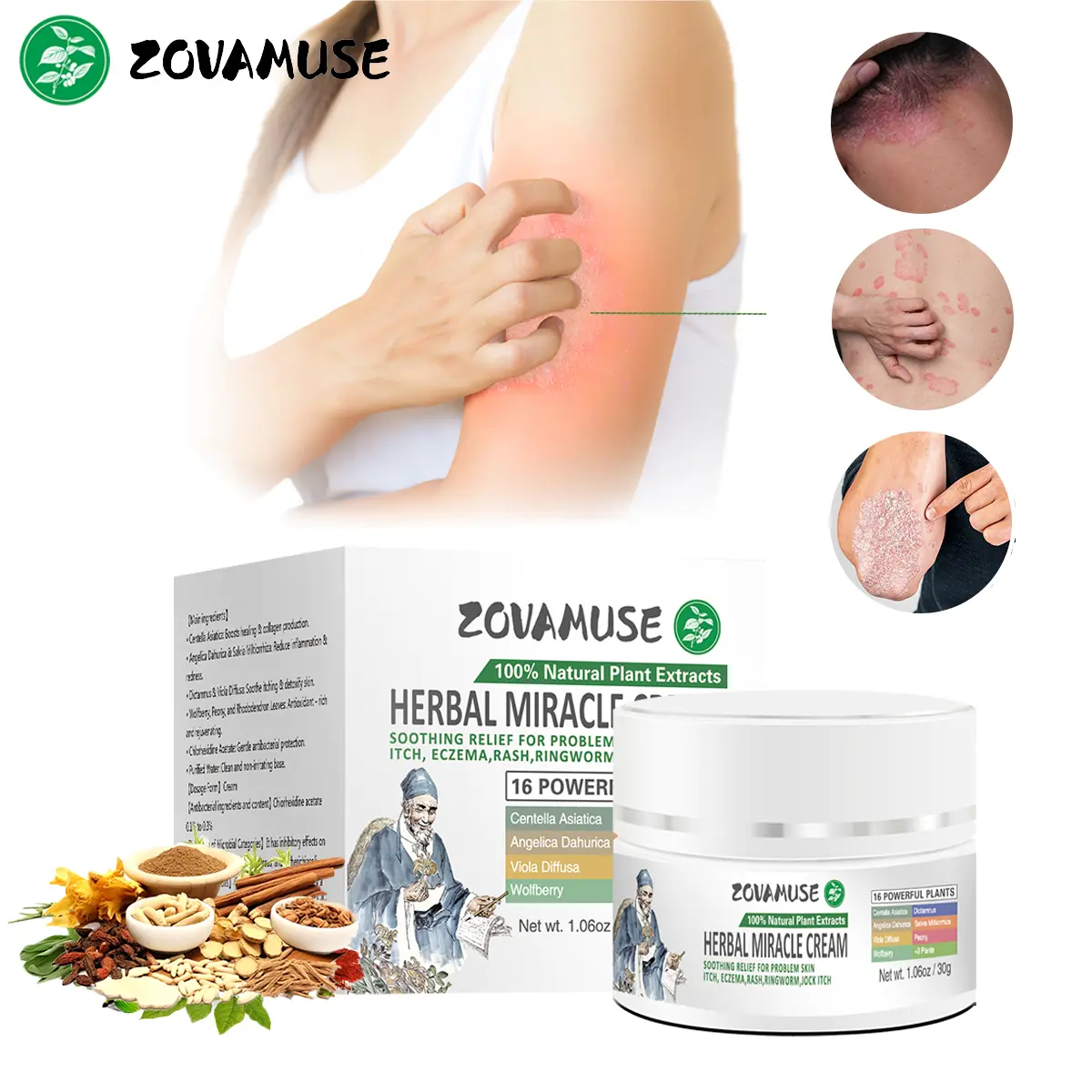 ZovaMuse Psoriasis & Eczema Cream - Natural Herbal Ointment for Itch Relief, Dry Skin & Sensitive Skin - Soothing & Hydrating Treatment - 30g body glaze Therapeutic Healthy