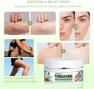 "Fungal King" — Gentle, Plant-Based Topical Care Cream for Seasonal Itching, Dryness, Cracking, and Peeling of the Feet and Body; Soothes Itching and Inhibits Bacteria