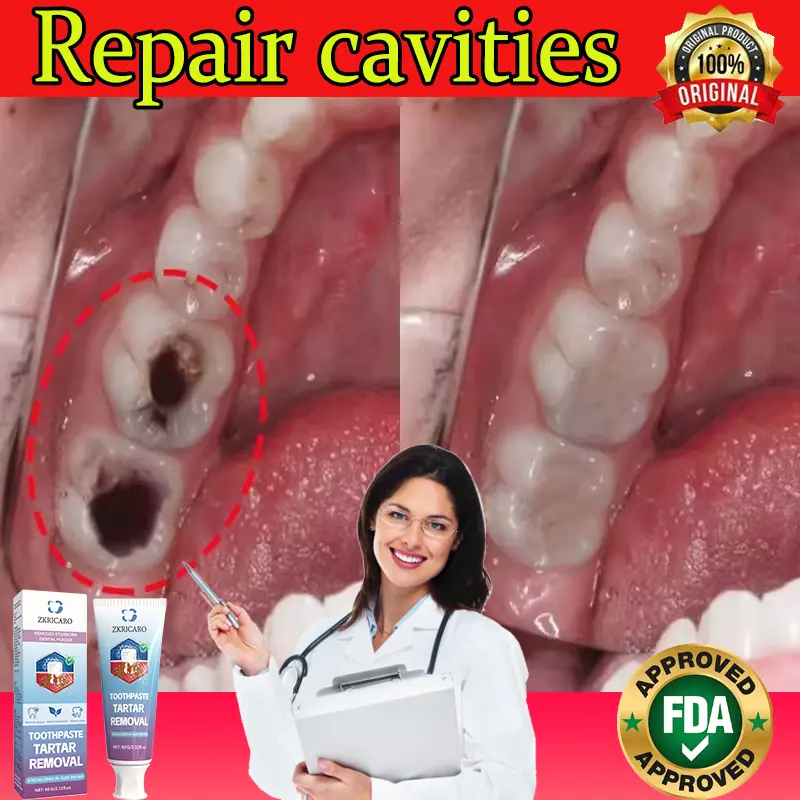 ZKRICARO Enamel Repair Toothpaste with Hydroxyapatite, Anti-Cavity & Anti-Decay, Gentle Cleaning, Low Irritation, Long-Lasting Fresh Breath, Moisturizing Oral Care, No Harsh Chemicals, Morning & Night Repair, Ideal for Sensitive Teeth & Whole Family Peppe