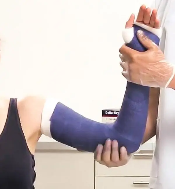 Delta Dry Waterproof Long Arm Cast Kit