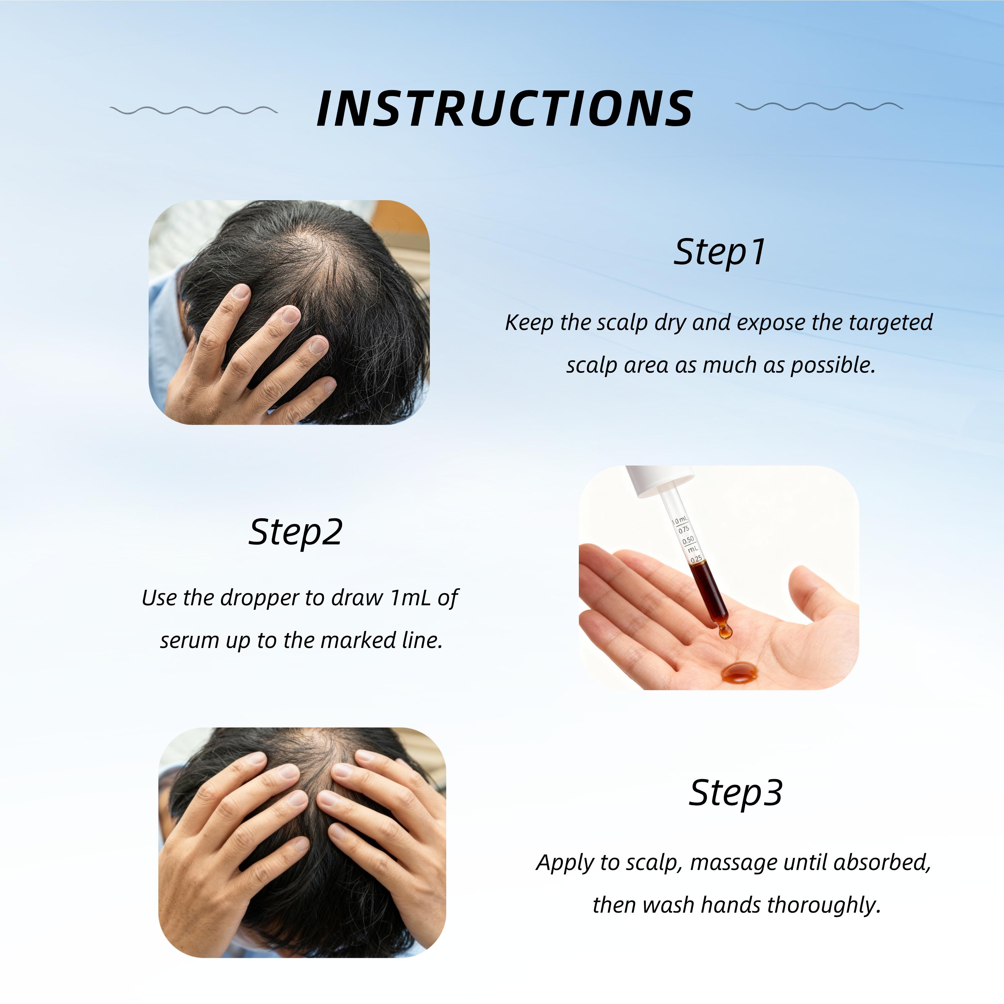 Sytael Hair Follicle Activating Shampoo for Anti-Hair Loss and Hair Growth uses pure natural plant extracts and is suitable for people with androgenetic alopecia, alopecia areata, postpartum, and post-hair transplant conditions.