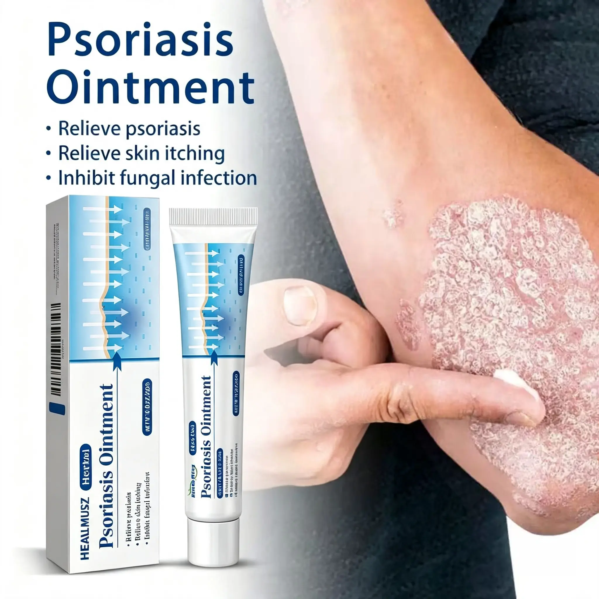 Healmusz Psoriasis Ointment - Relieve Psoriasis & Skin Itching, Inhibit Fungal Infection, Effective Topical Treatment