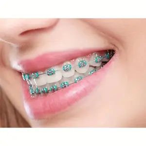 SW2025 Colorful Temporary Teeth Decorations  Cosplay Braces with Rubber Bands  Stainless Steel |               Vibrant Party Style for Halloween, Thanksgiving, Christmas |       Durable, Easy-to-Use Beauty Retouching Gear  Fashion Dental Bracket Accessor