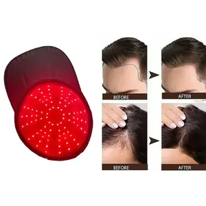 Light Therapy Hair Growth Cap, LED Near Infrared Anti-Hair Loss Device, Relaxing Head Treatment Machine, Model Lhm-003, Hair Growth Enhancer