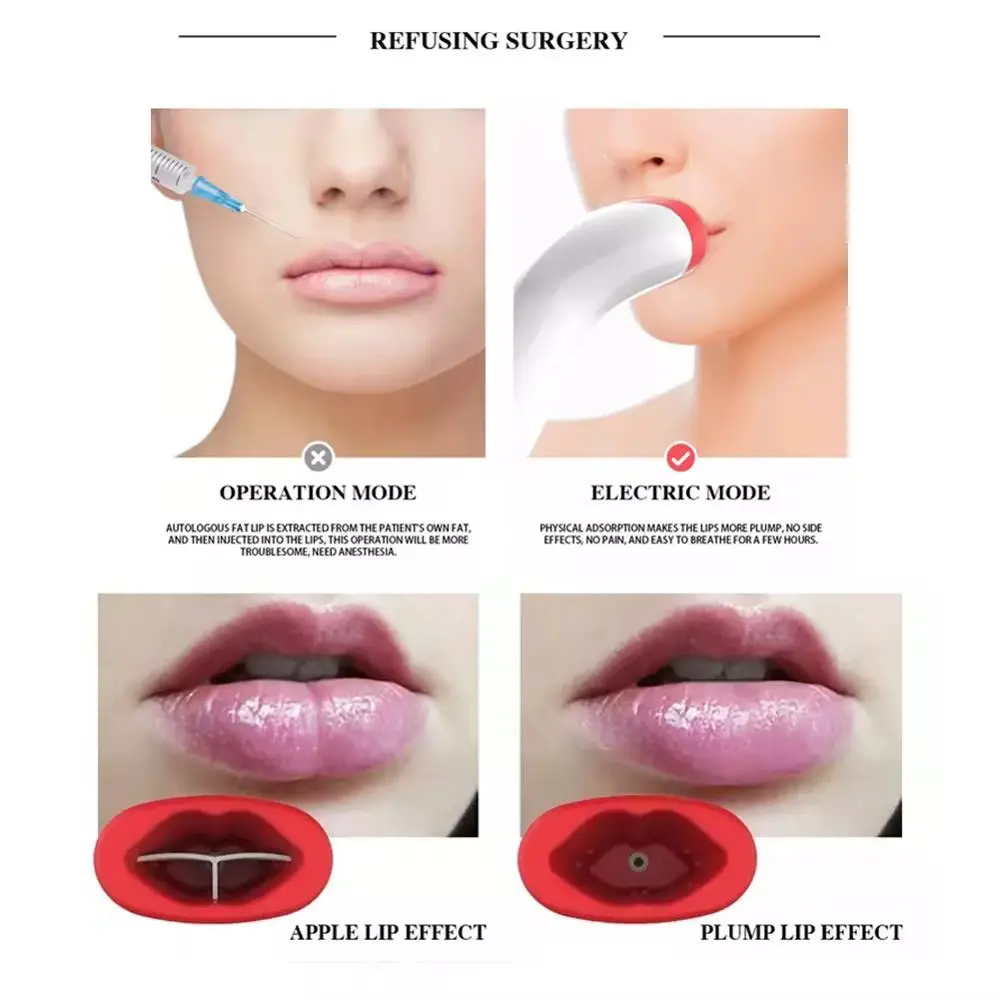 Automatic Silicone Lip Plumper Device  Fuller-looking lips. No needles. No chemicals. Just results.