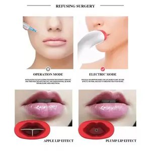Automatic Silicone Lip Plumper Device  Fuller-looking lips. No needles. No chemicals. Just results.