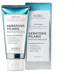 KP Bump Eraser Body Scrub with 10% AHA | Keratosis Pilaris Treatment | Bump Eraser Body Scrub | Ingrown Hair Treatment | Clears Strawberry Legs | Soothes Redness, Dryness & Flaky Skin