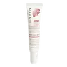 Acne Control Spot Treatment