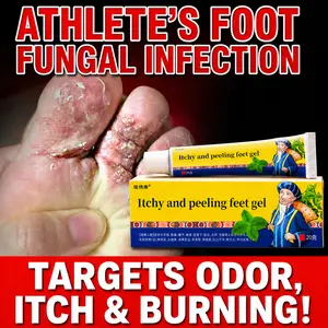 Herbal foot cream that fights bacteria and relieves itching; improves itchy feet, foot odor, peeling, blisters, and rotten toes; provides deep antifungal action and soothes discomfort in the feet; gently repairs recurring foot fungus issues; a foot care b