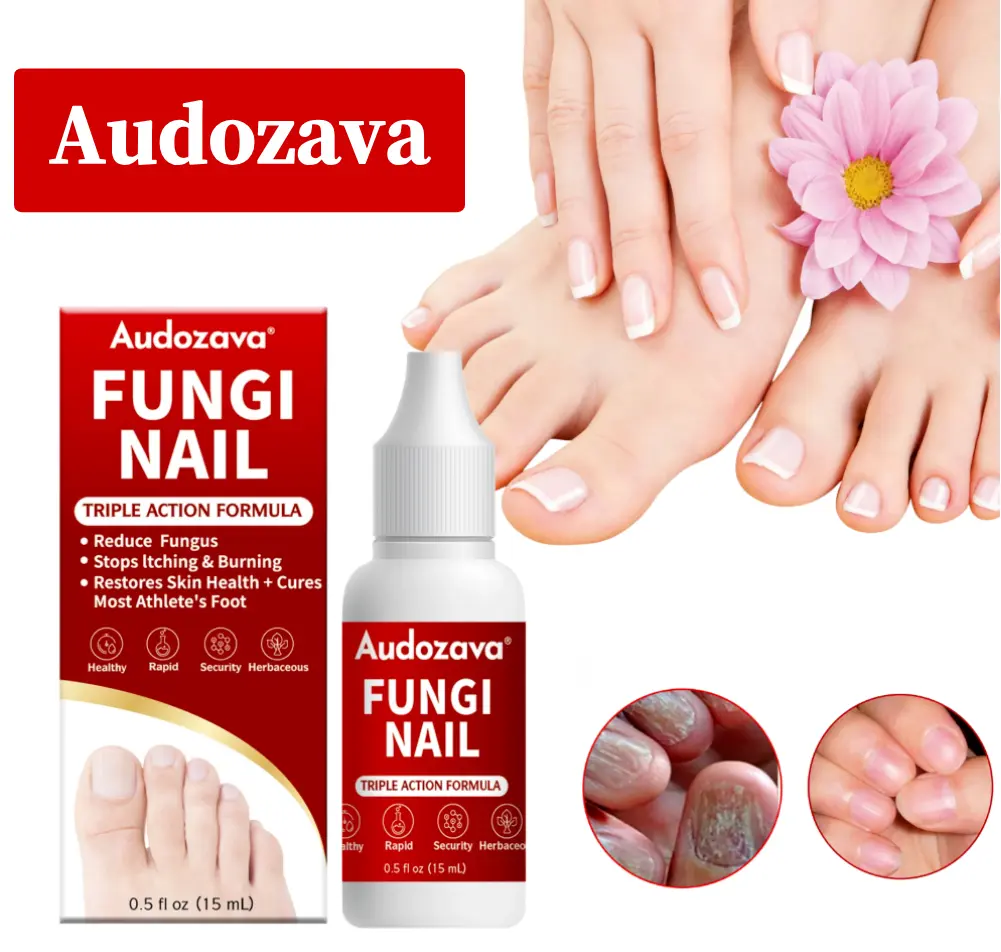 FUNGI Fungus Eliminator Treatment Liquid, Toenail Fungus Solution and Fungal Care Nail Repair for Damaged, Discolored, Thick Toenails & Fingernails, Toe Treatment Nail Repair