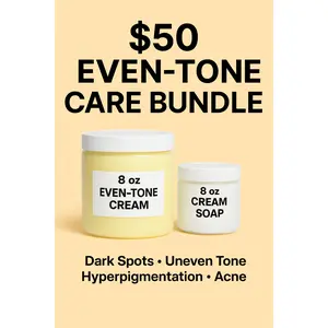 Even-Tone Care Bundle (Mild Strength) – Dark Spot, Acne Mark & Hyperpigmentation Brightening Set + Free 2oz Cream Soap