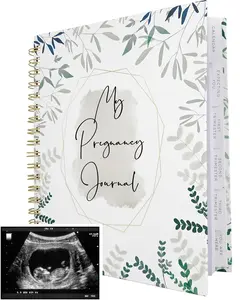 Pregnancy Journal for First Time Moms | Weekly Pregnancy Tracker & Baby Book | 200-Page Maternity Journal | Pregnancy Must Haves Keepsake Gift | Premium Hardcover Pregnancy Book for Expecting Moms