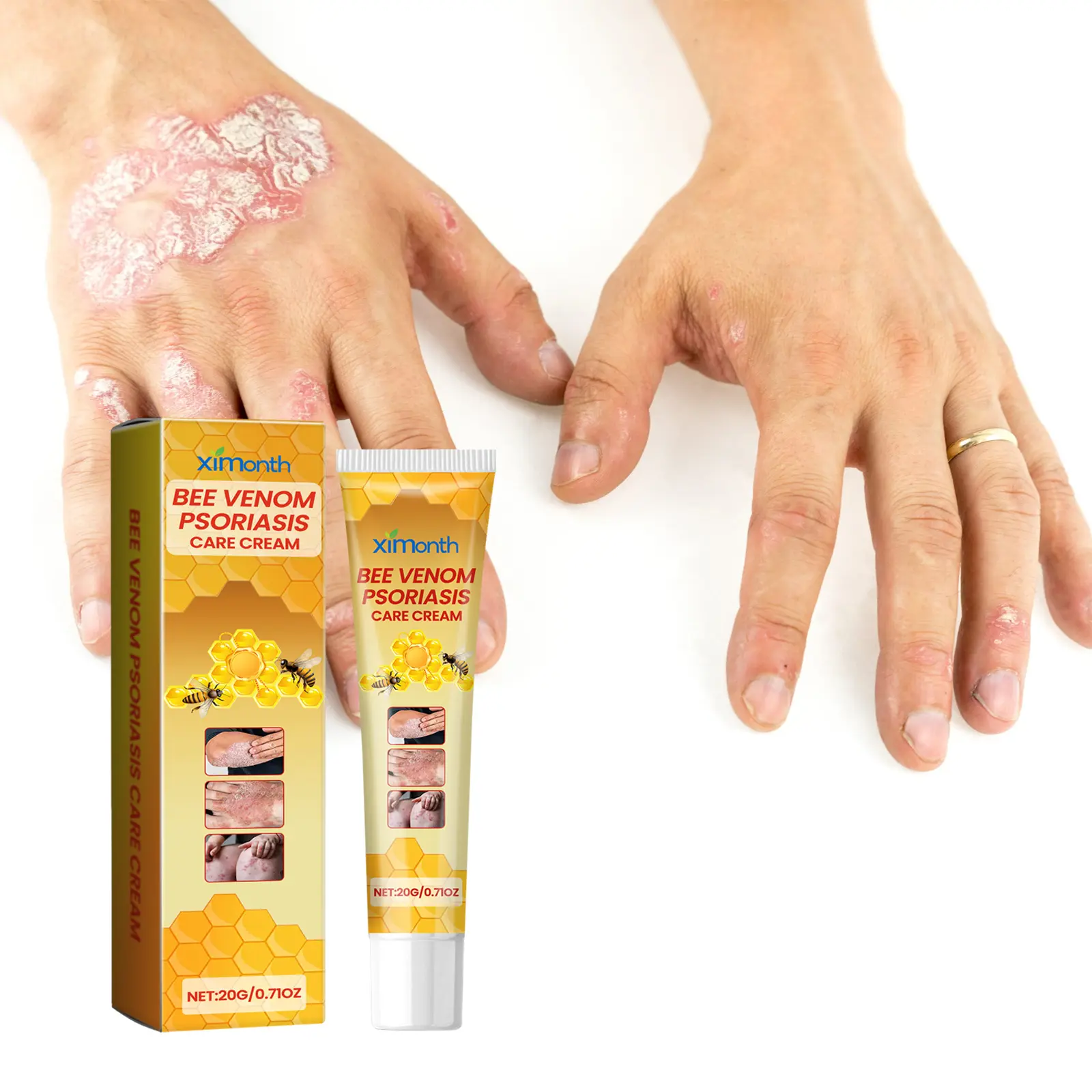 Ximonth Lichen Cream, Moisturizing Skin Therapy Ointment with Peppermint Leaf Oil for Itching, Redness & Swelling Relief