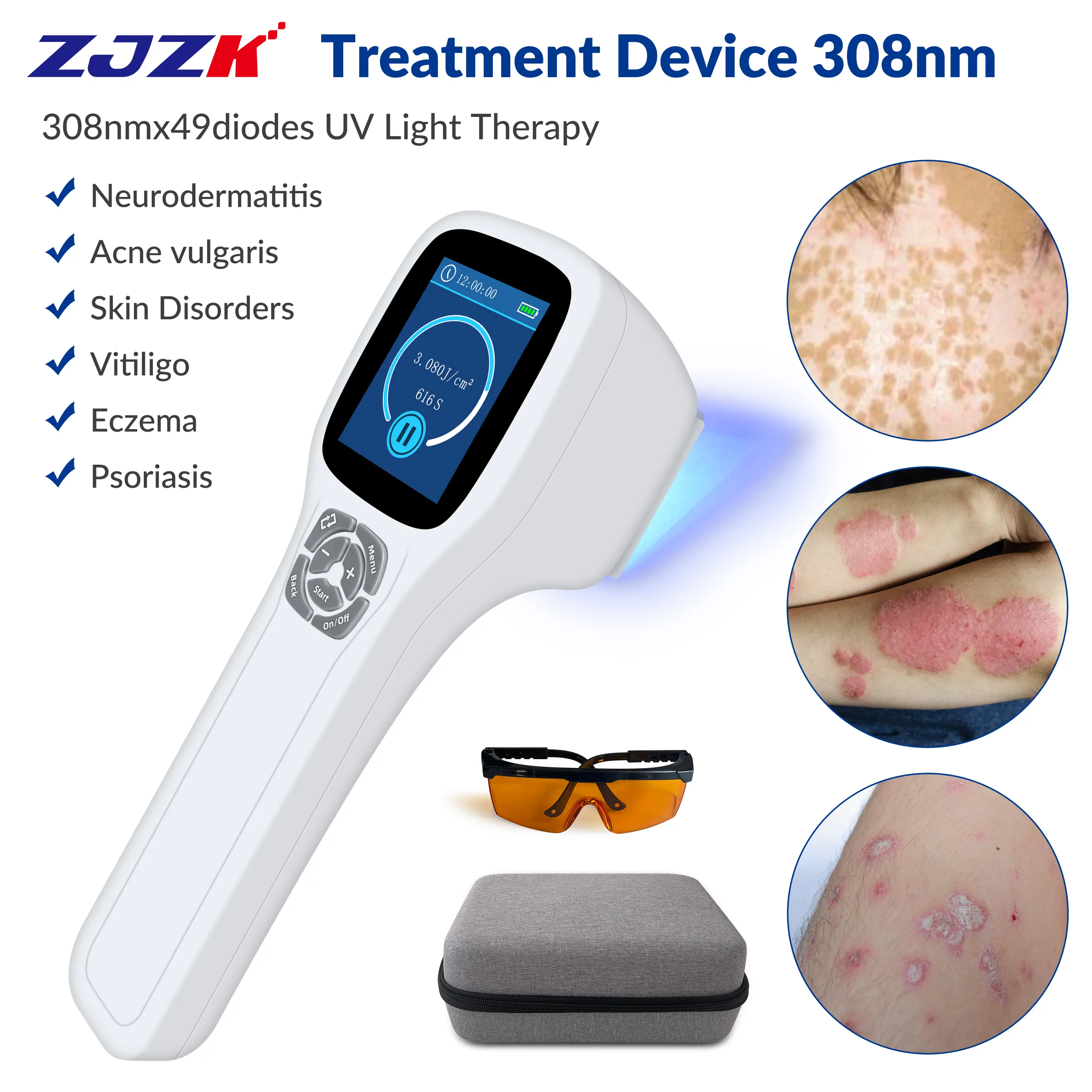 ZJZK 308nm Excimer Phototherapy Device with 49 Diodes, Blue Light Therapy for Vitiligo, Psoriasis, Eczema, Atopic Dermatitis, Fungal Skin Disease, Hypopigmentation, Safe Targeted Home Use, Fast Recovery, Prevent Recurrence, Portable Handheld