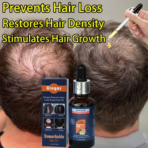 Clinically Proven Ginger Hair Growth Oil – Dermatologist Recommended! Natural Extracts with Caffeine & Rosemary to Repair Follicles, Stop Hair Loss, Boost Regrowth, Deep Nourishment for Men & Women. Visible Thick, Healthy Hair in 7 Days!