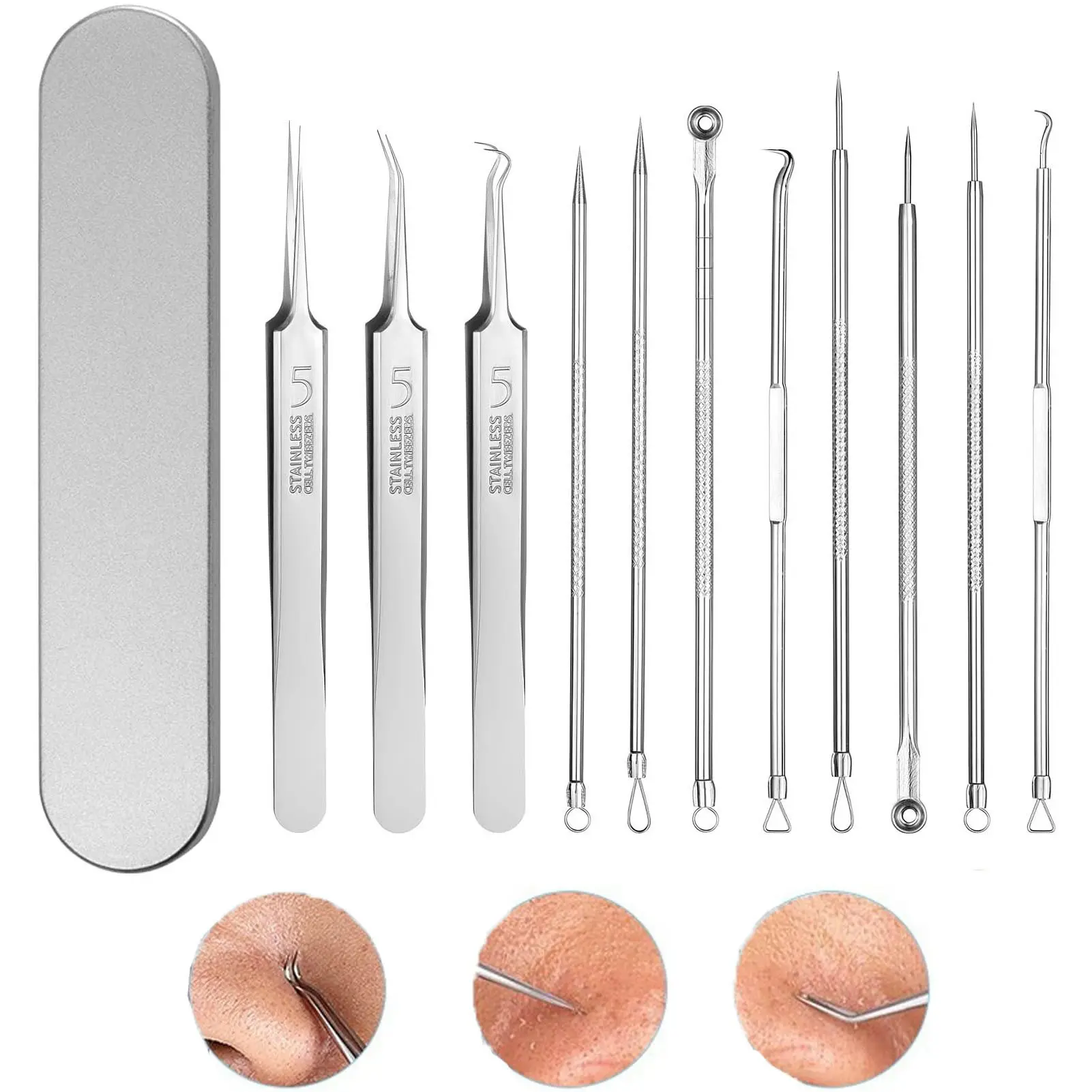 11-Piece Professional Blackhead Remover Tool Kit for Facial Acne Removal, Stainless Steel Pimple Extractor with Anti-Allergic Plated Needles and Metal Case, Skincare Set for All Skin Types, Blackhead Removal, Portable, Acne Areas