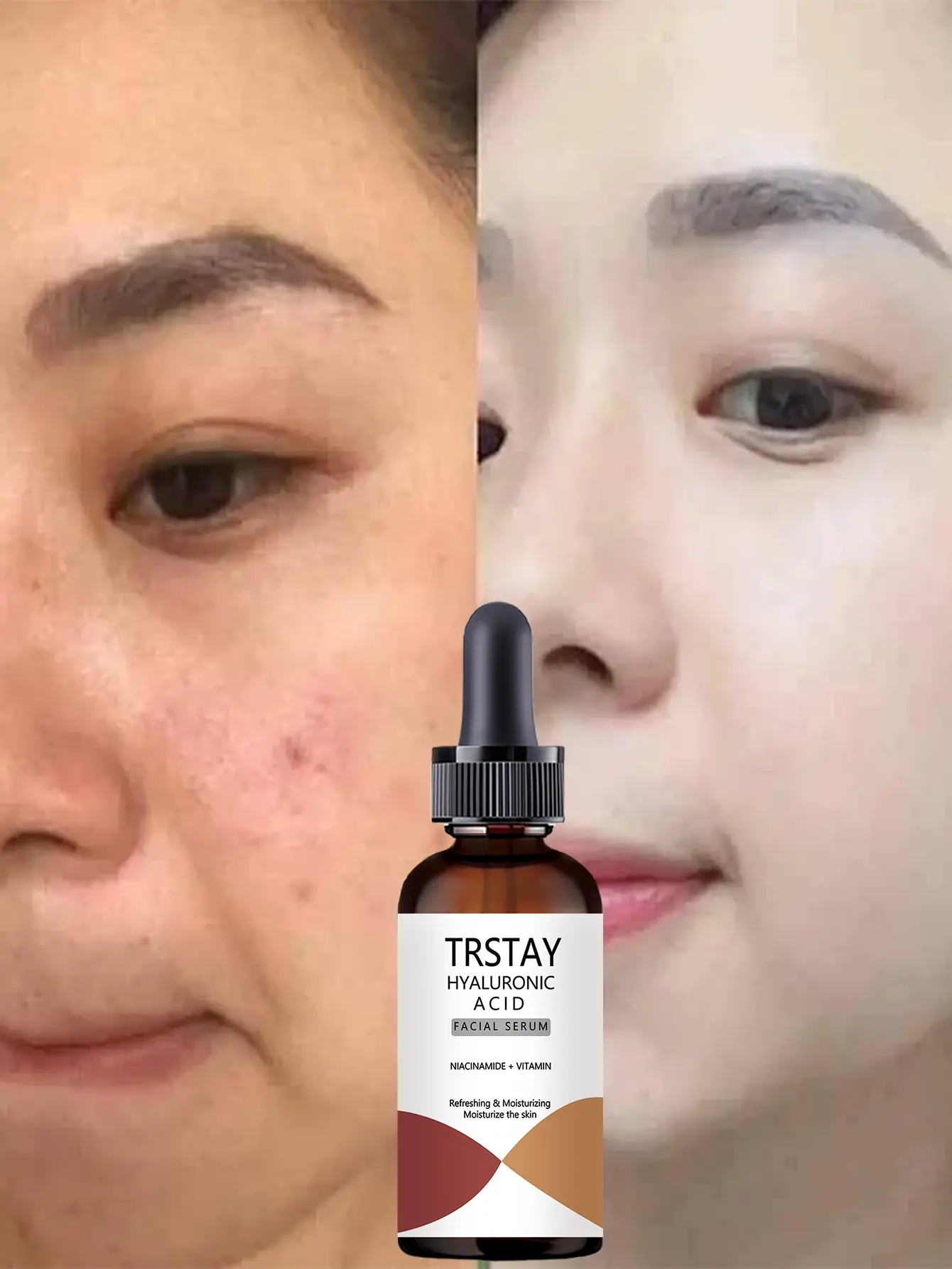 50ml Facial Moisturizing Serum – Enriched with hyaluronic acid and niacinamide; provides rapid hydration, leaving skin soft, smooth, and radiant. Suitable for daily facial moisturizing. Hydrator Serum