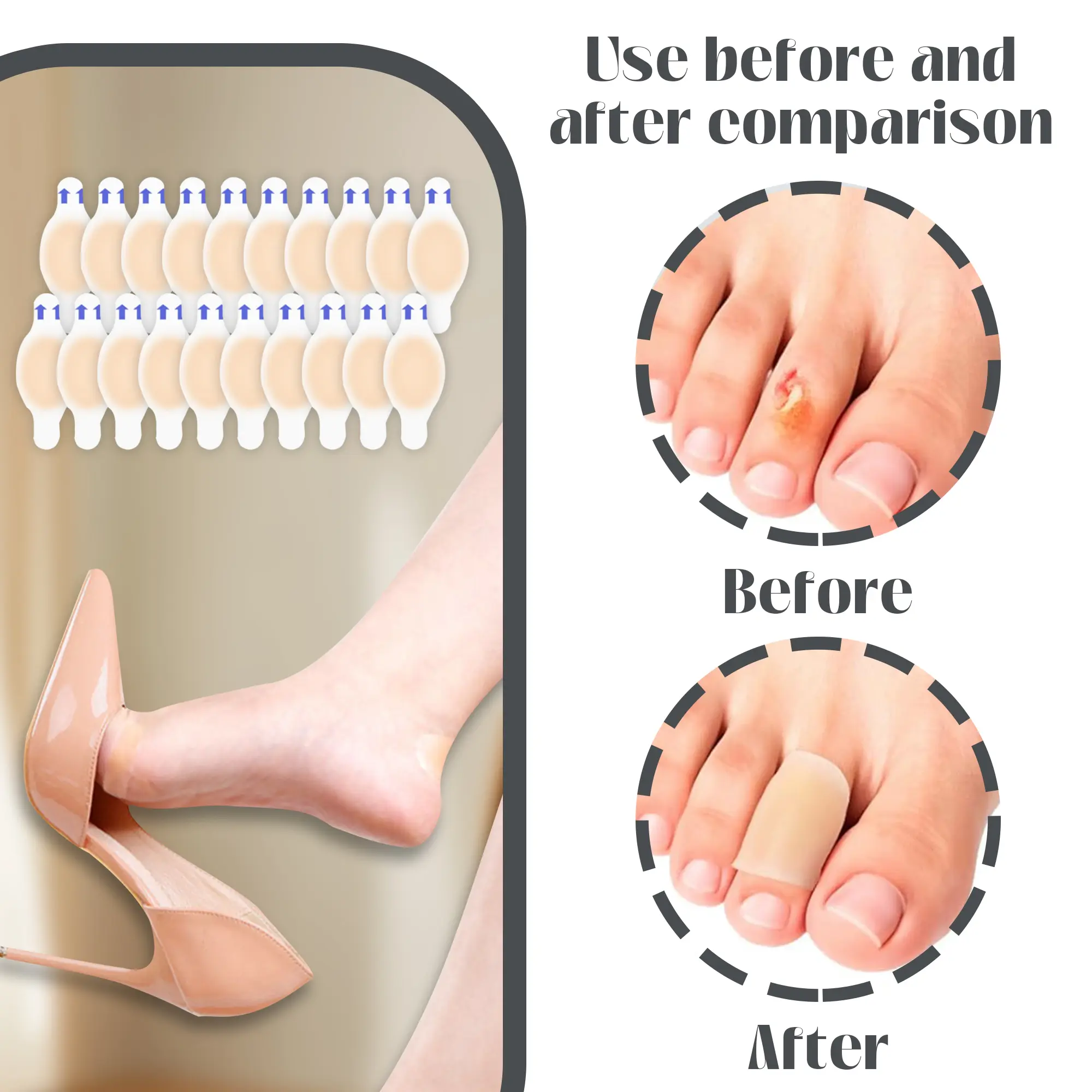20 Counts Hydrocolloid Blister Bandages for Feet, Heel Prevention & Recovery Pads that cushion skin from pressure Water Proof