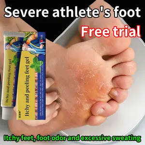 Athlete's Foot Cream: For foot odor, itchy feet, sweaty feet, cracked feet, blisters, peeling, athlete's foot, fungal infections and anti-itch relief.